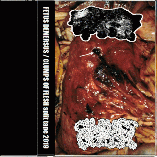 Fetus Demersus : Clumps Of Flesh - Fetus Demersus